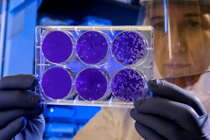 Legionnaires’ disease outbreak reported in southwestern Ontario